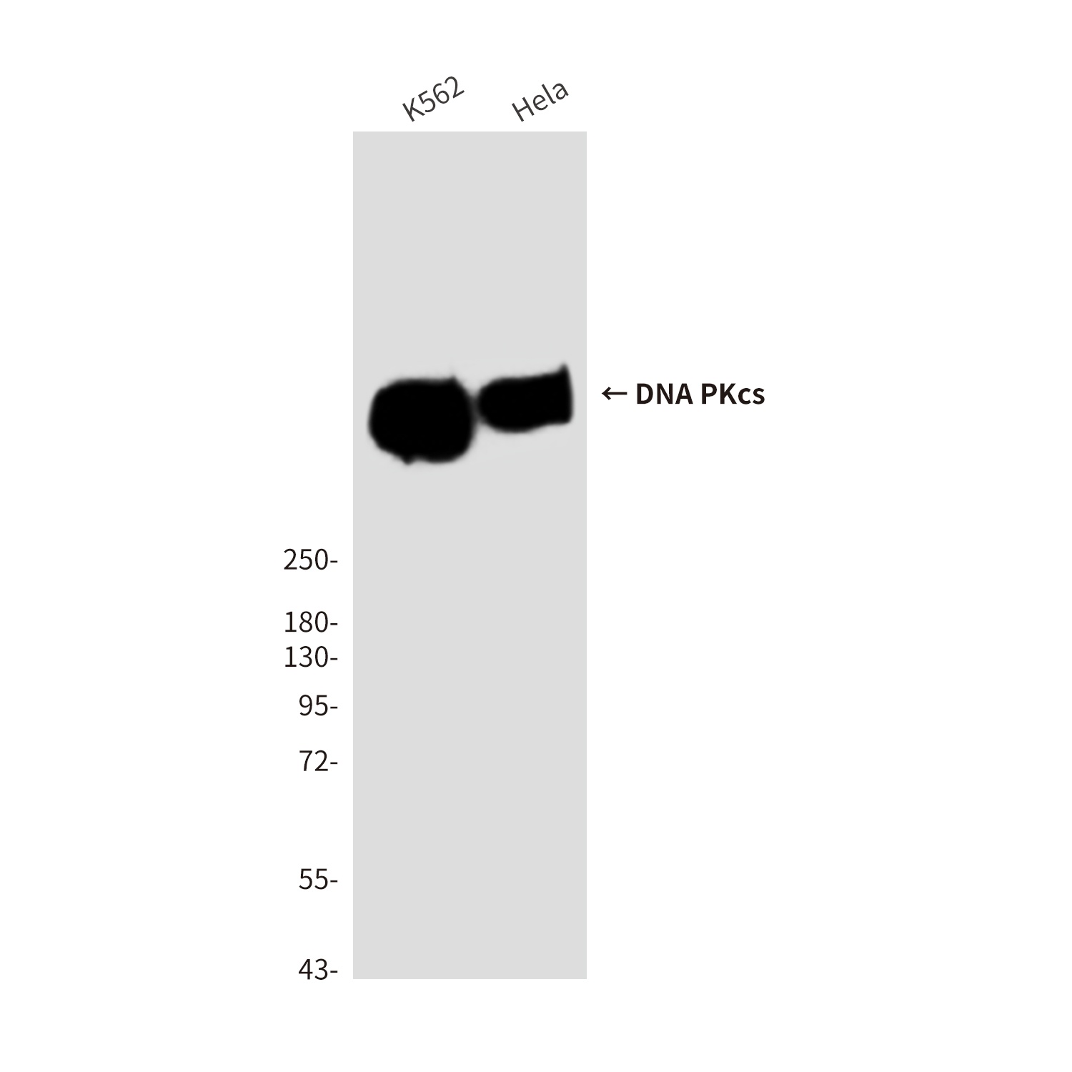 DNA PKcs (6D1) Mouse mAb