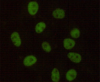 DNA PKcs (6D1) Mouse mAb