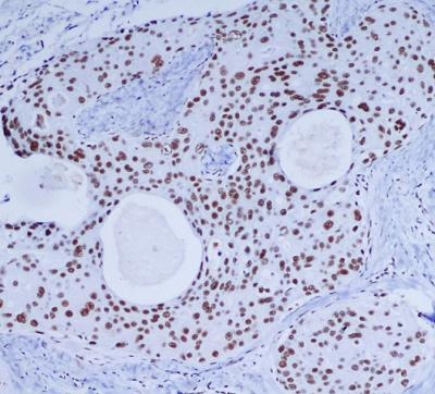 DNA PKcs (6D1) Mouse mAb