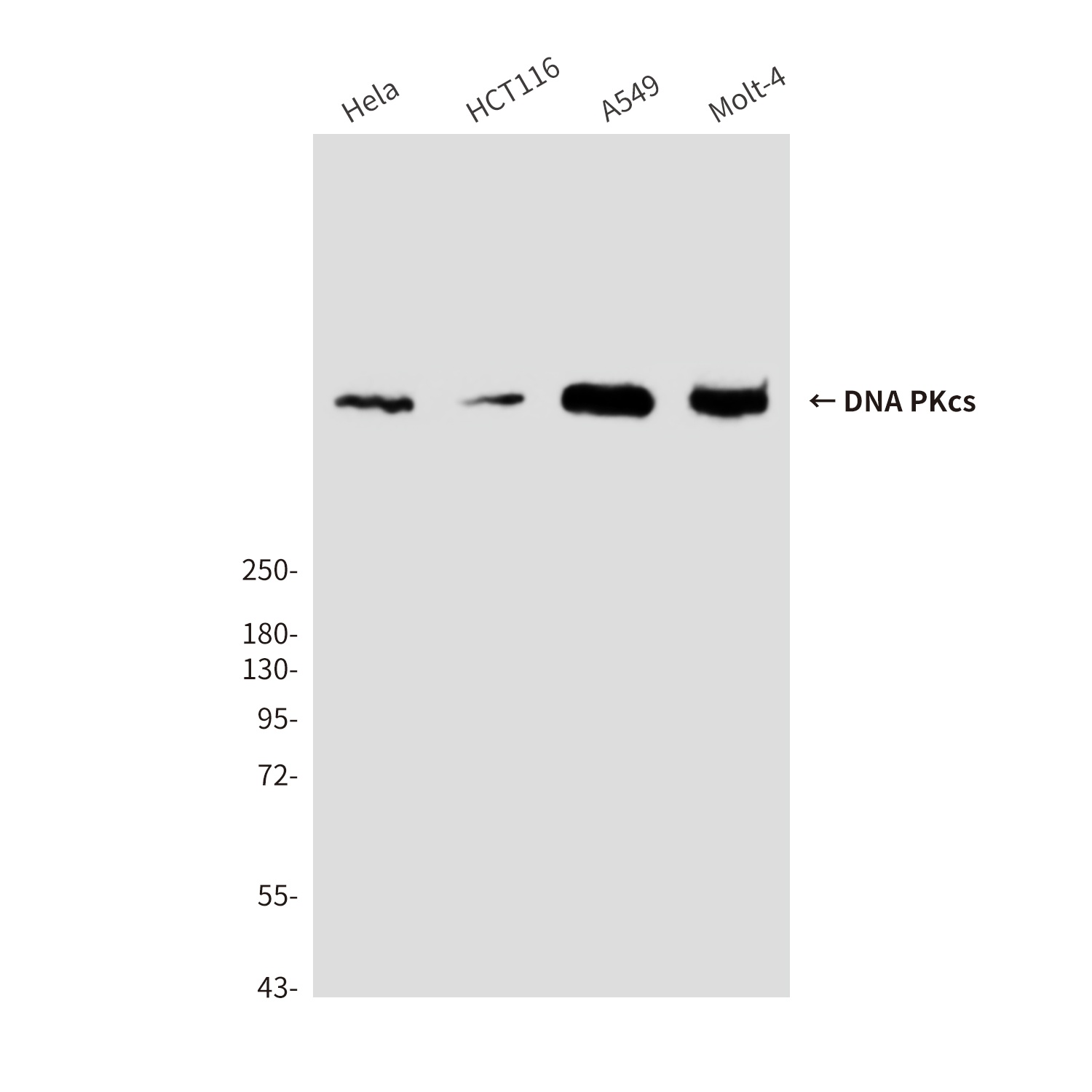 DNA PKcs (6D1) Mouse mAb