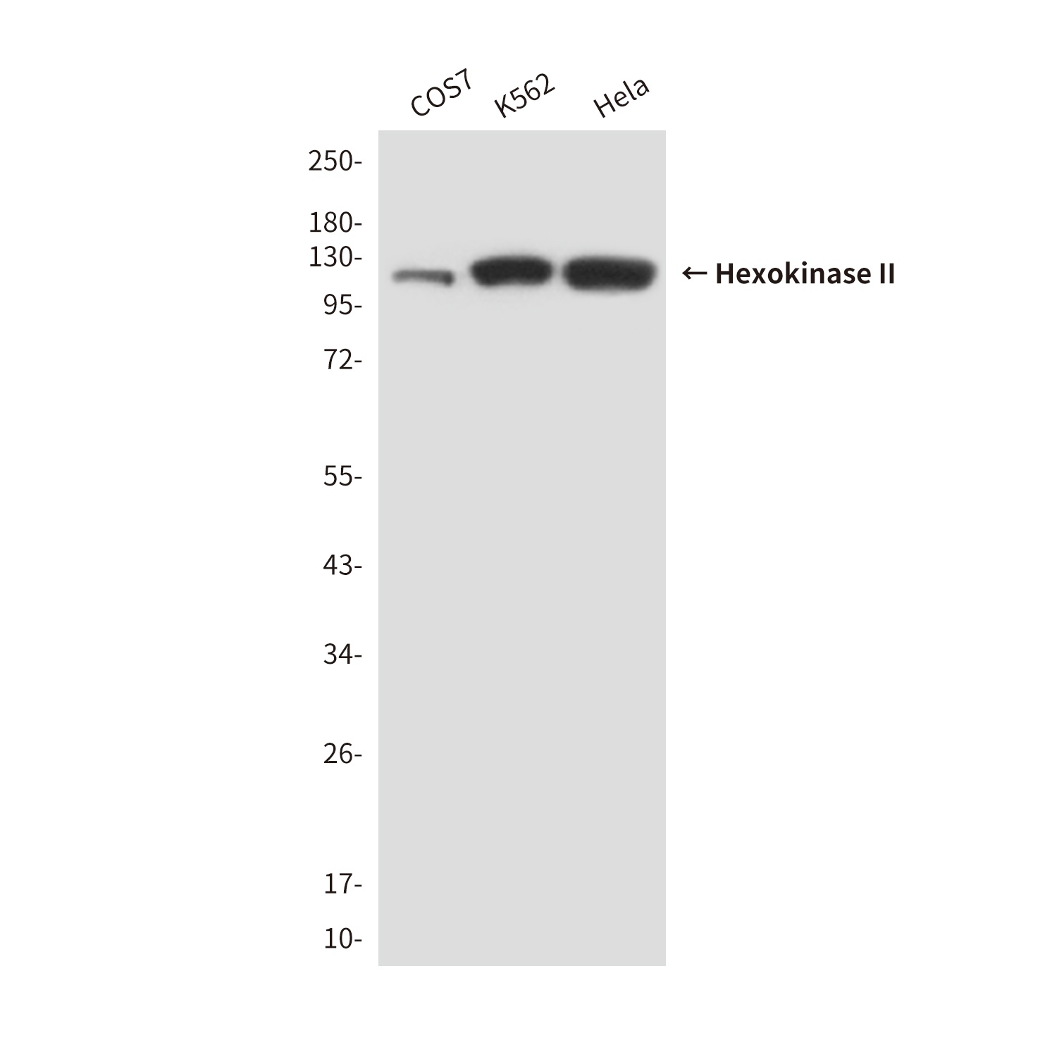 Hexokinase II (3B9) Mouse mAb