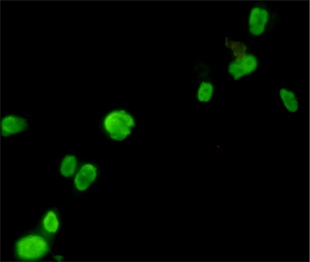 FOXP3 Mouse (7H9) mAb