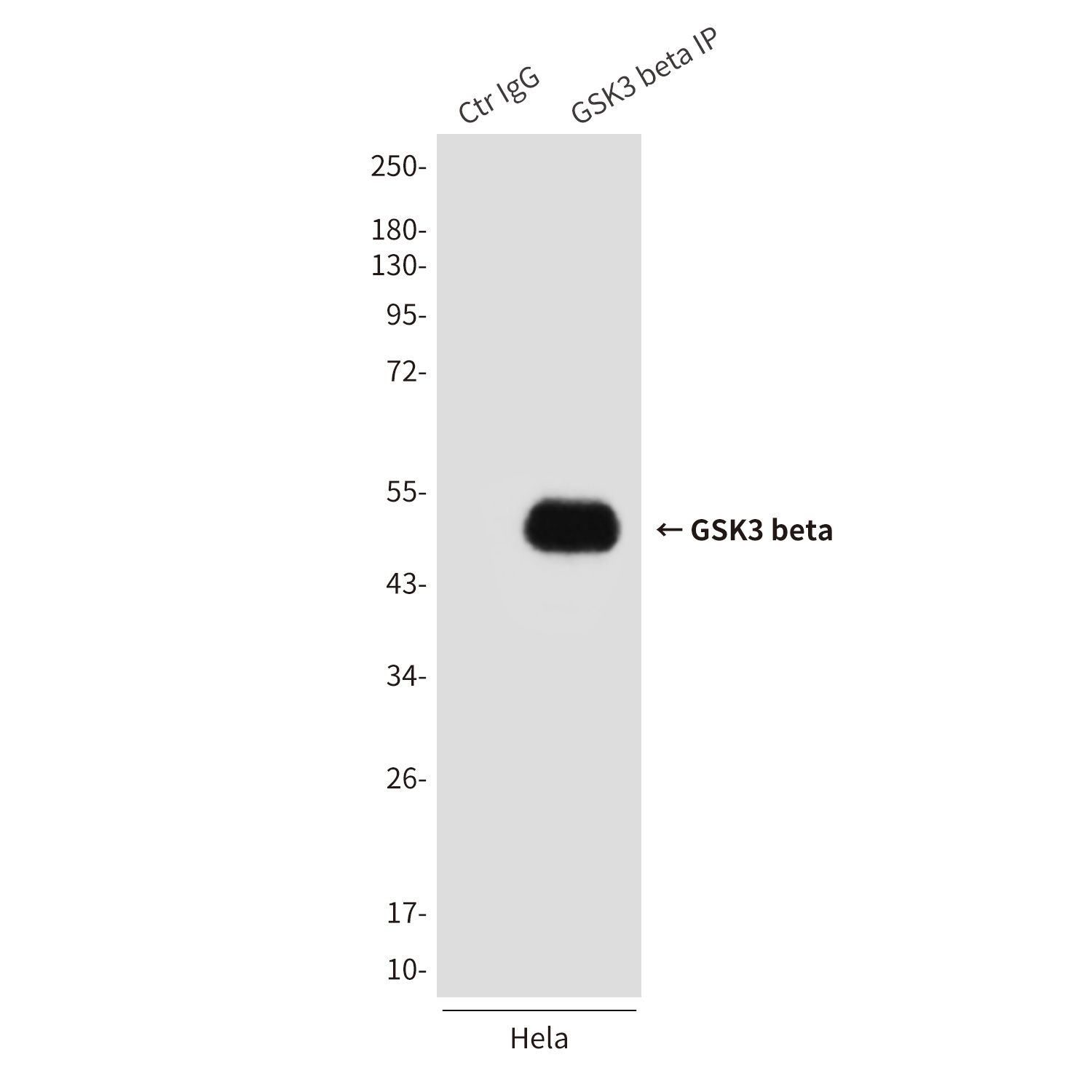 GSK3 beta (2E6) Mouse mAb