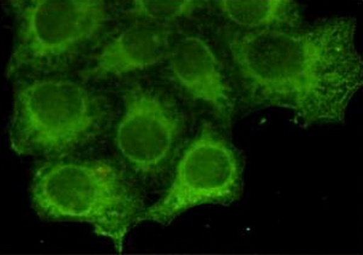 KRT18 Antibody