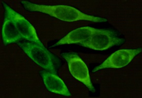 ICAM1 (4F5) Mouse mAb