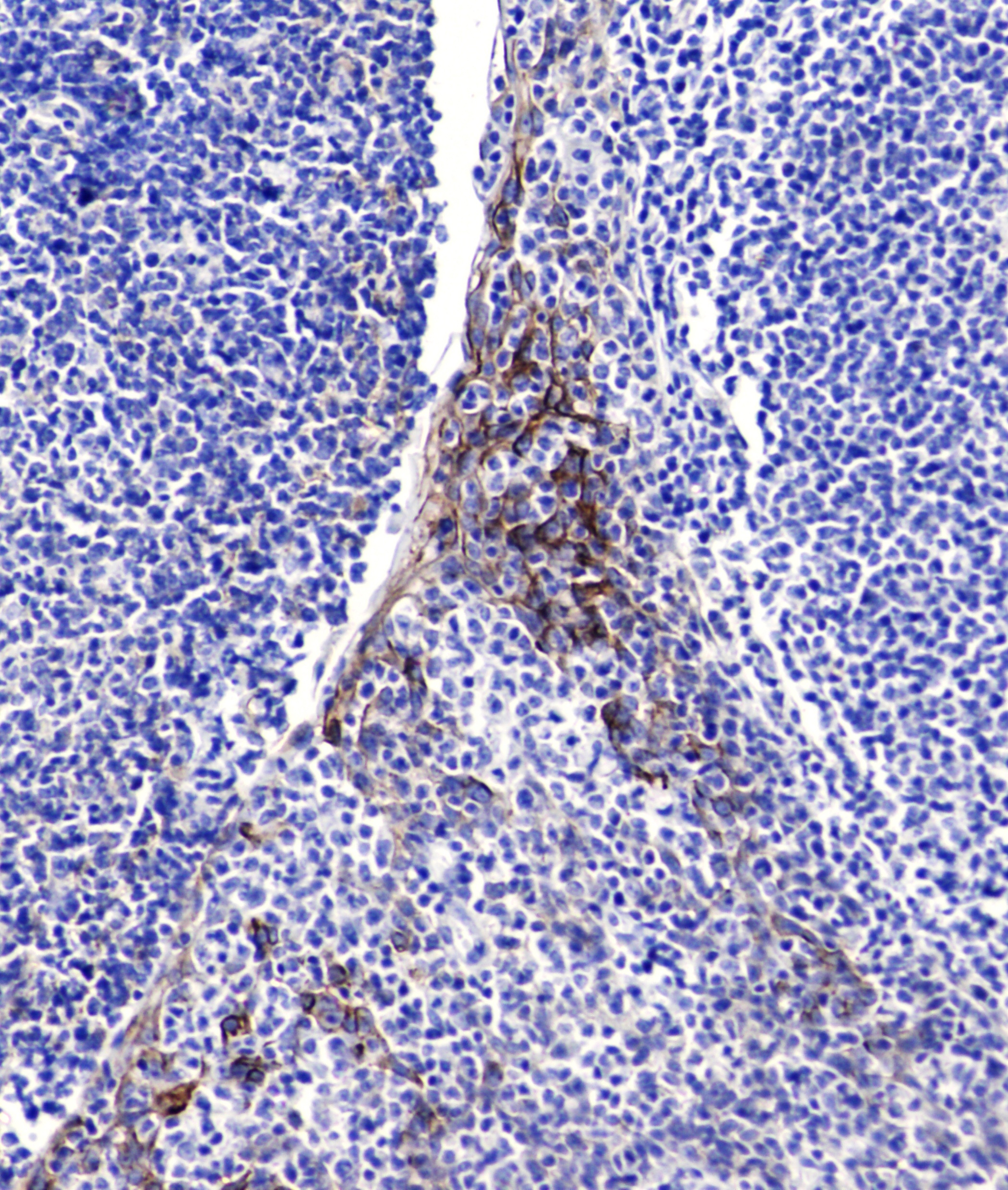 ICAM1 (1C7) Mouse mAb