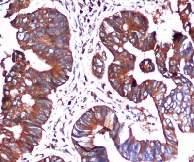 HSPA5 Antibody