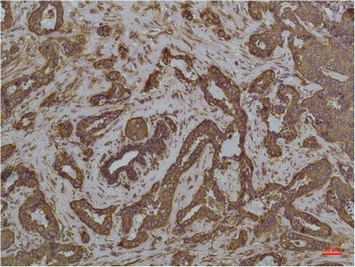 GRP78 BiP (6H7) Mouse mAb