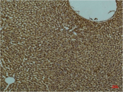 PIK3R1 Antibody