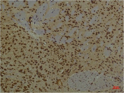 PIK3R1 Antibody