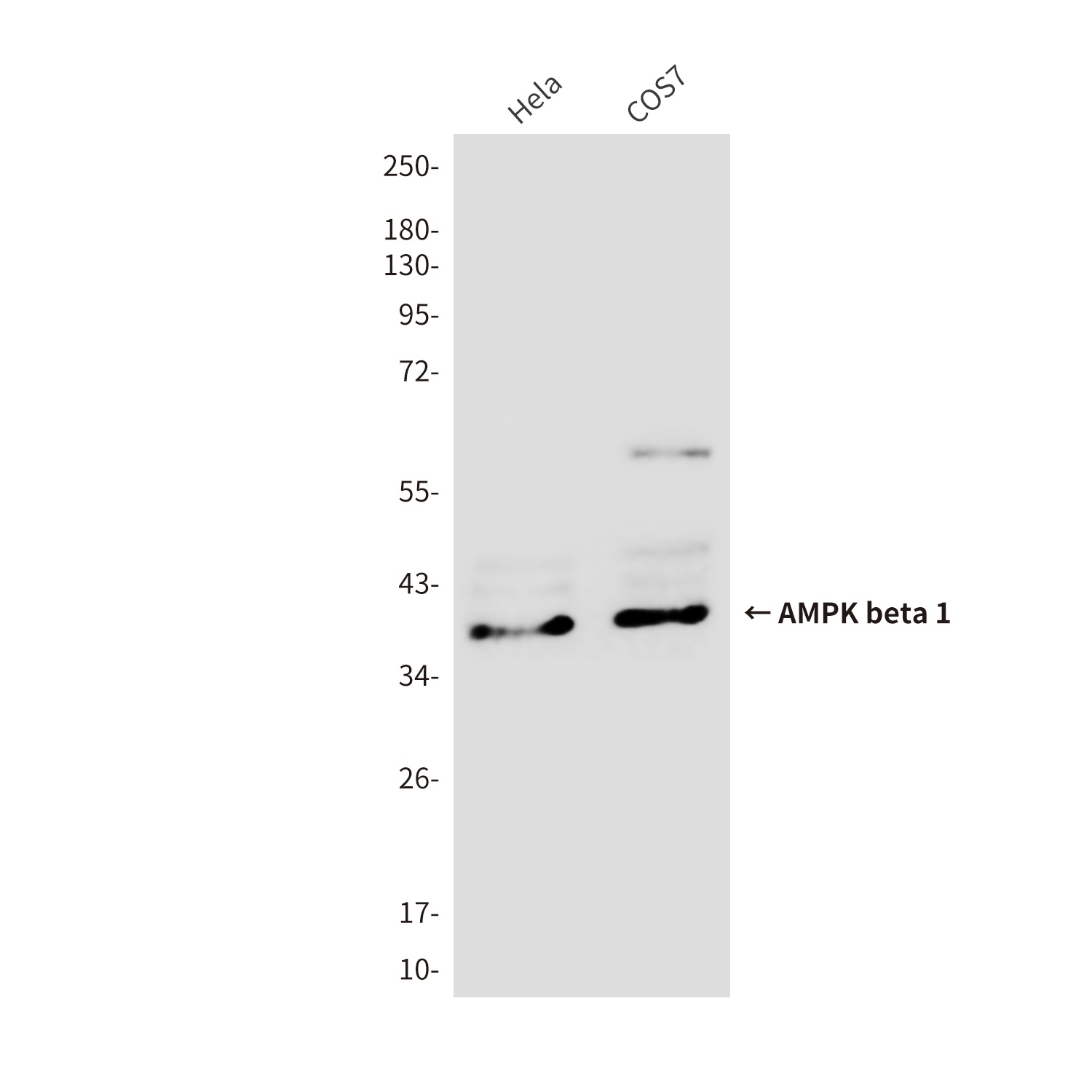 AMPK beta 1 Mouse mAb