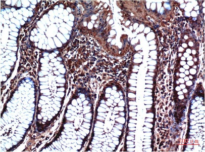 GSK3 beta (4C4) Mouse mAb