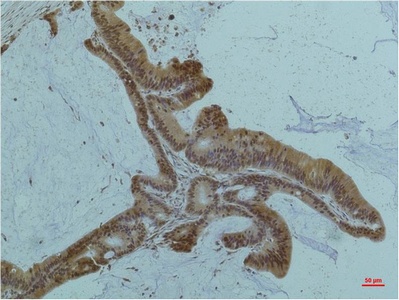 Smad2/3 (6F7) Mouse mAb