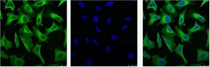 EGFR (3A9) Mouse mAb