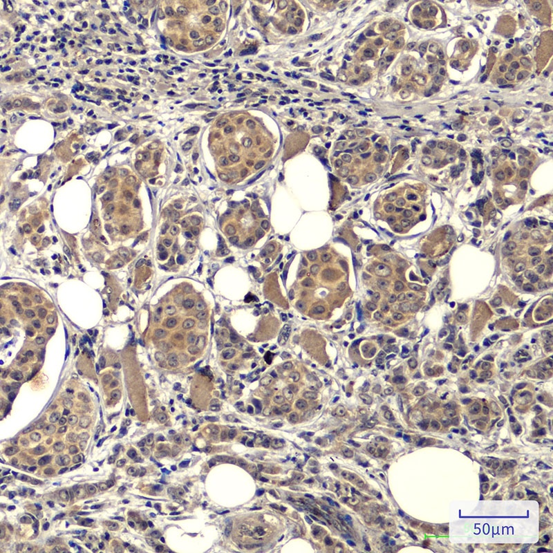 EGFR (3A9) Mouse mAb