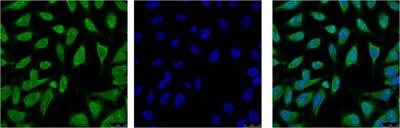 Hsp70 1A (1D9) Mouse mAb