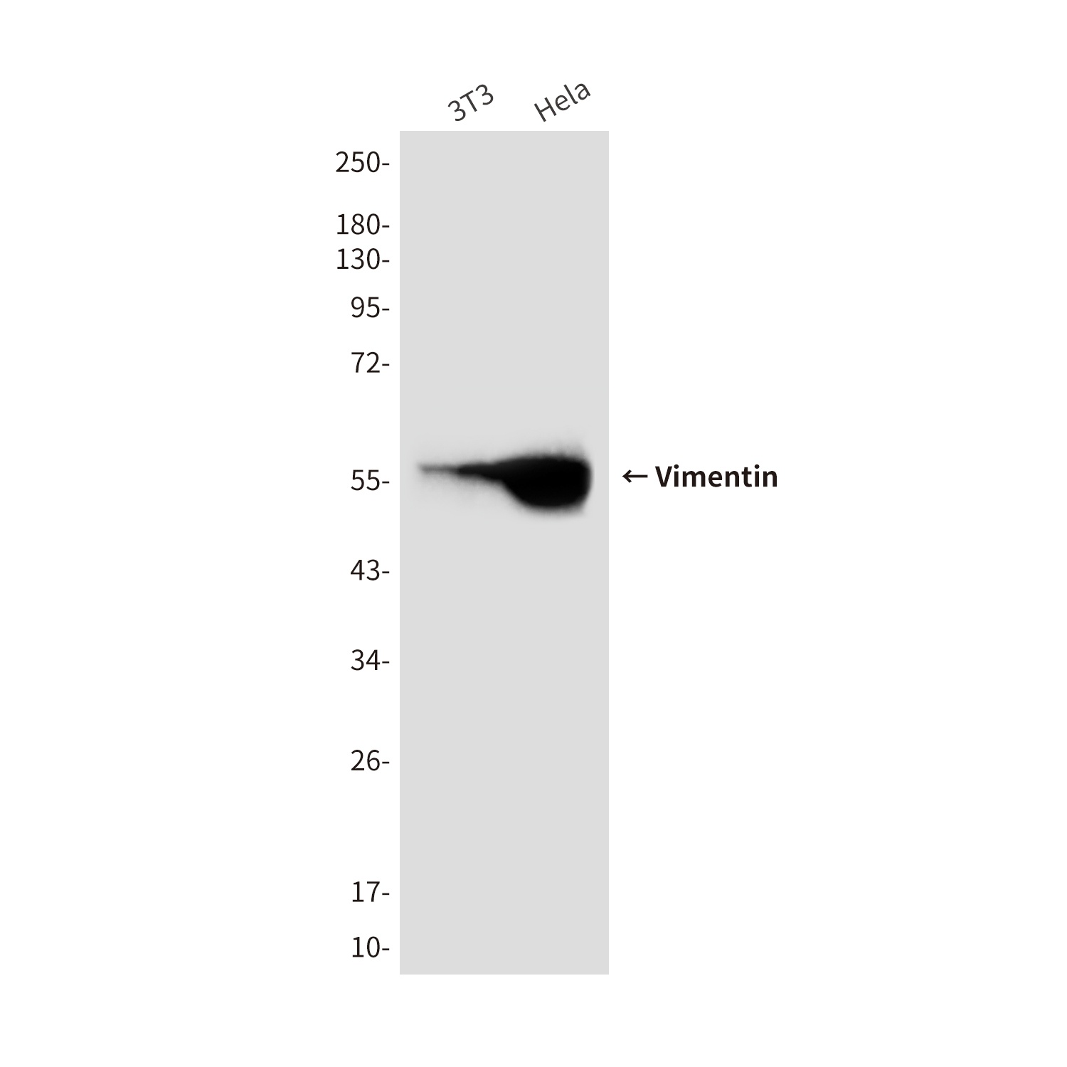 Vimentin (10E2) Mouse mAb