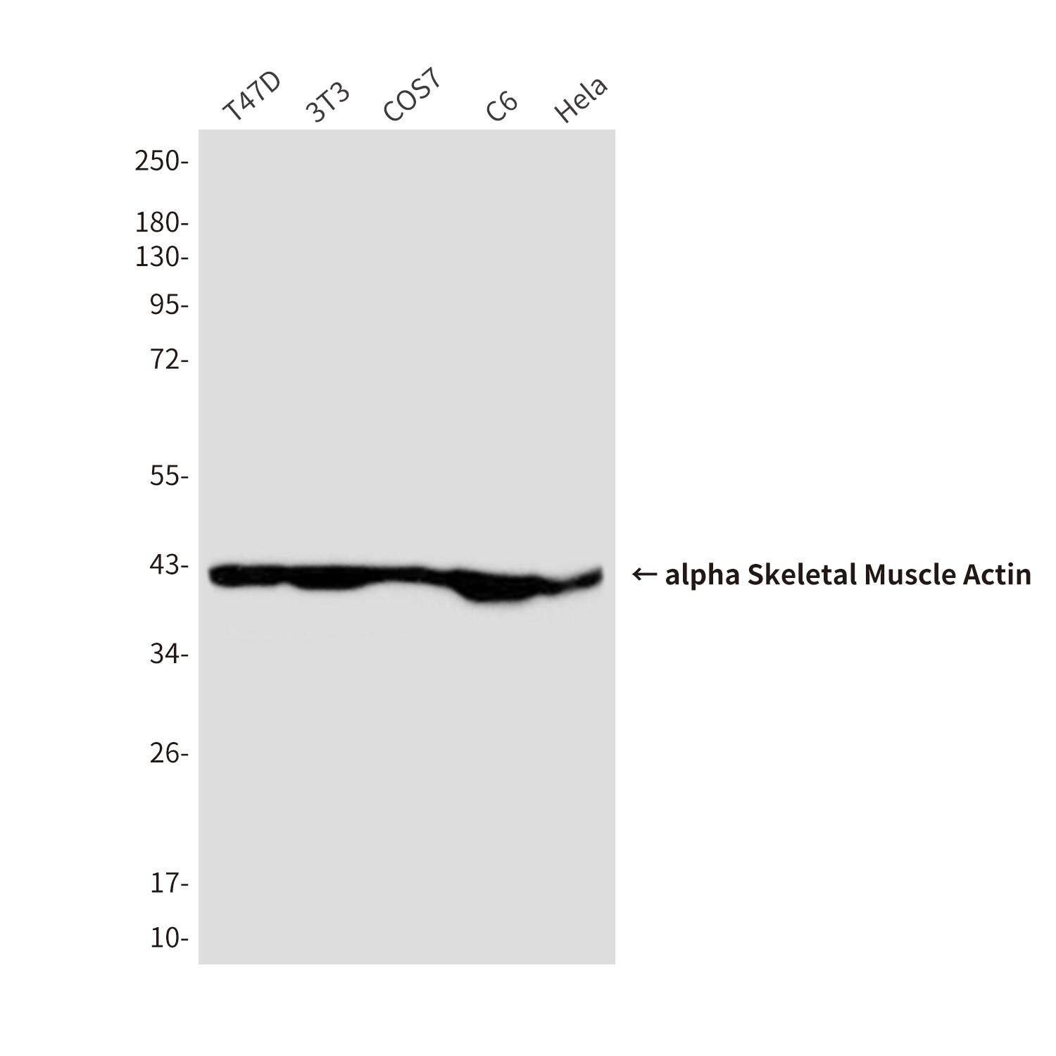 alpha Skeletal Muscle Actin (2B10) Mouse mAb