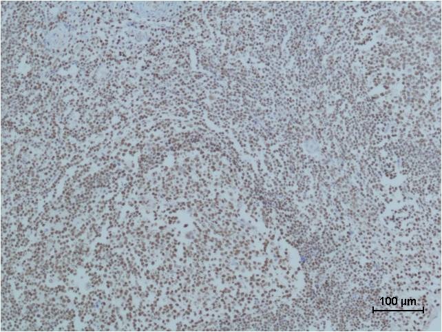 PARP1 Antibody