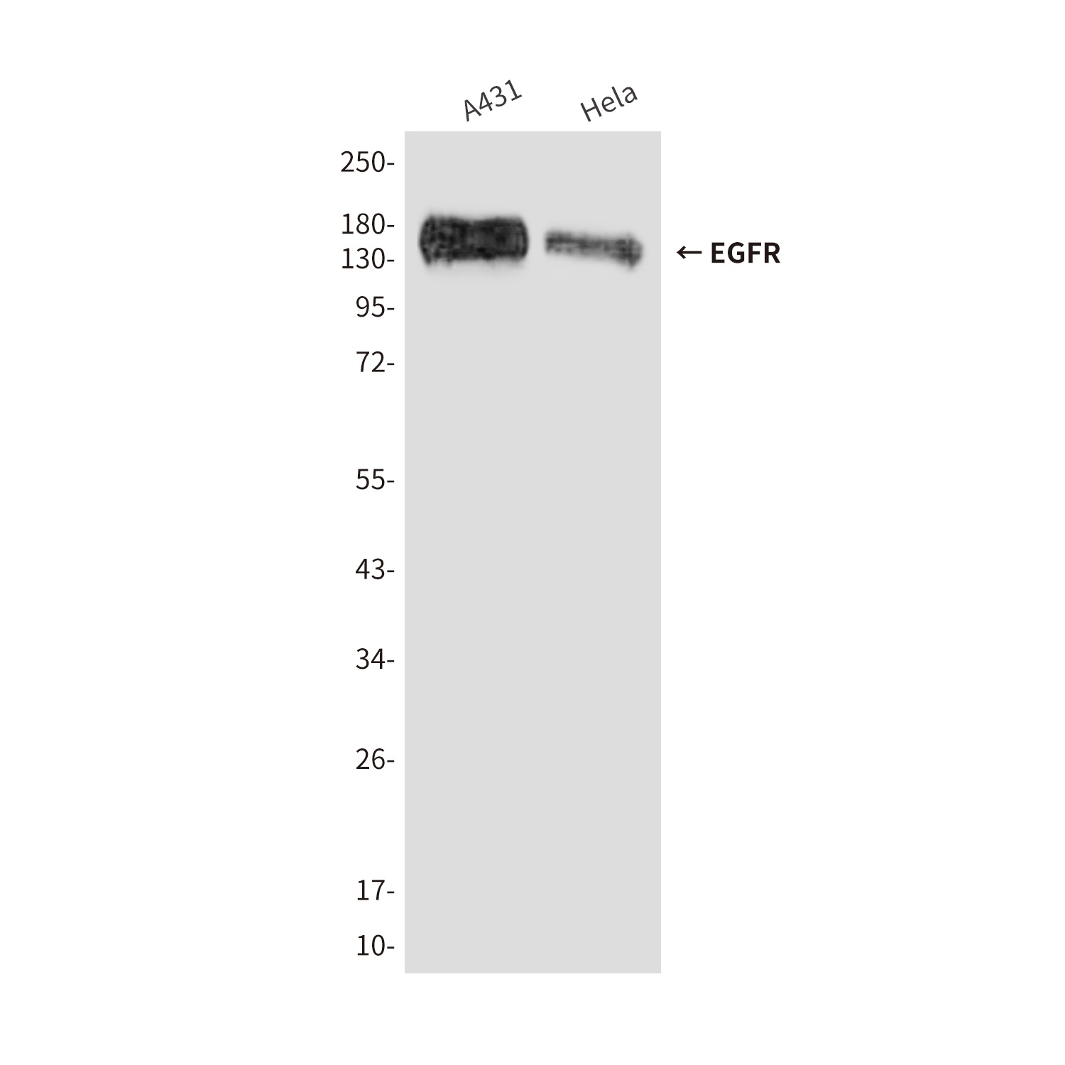 EGFR (5E9) Mouse mAb