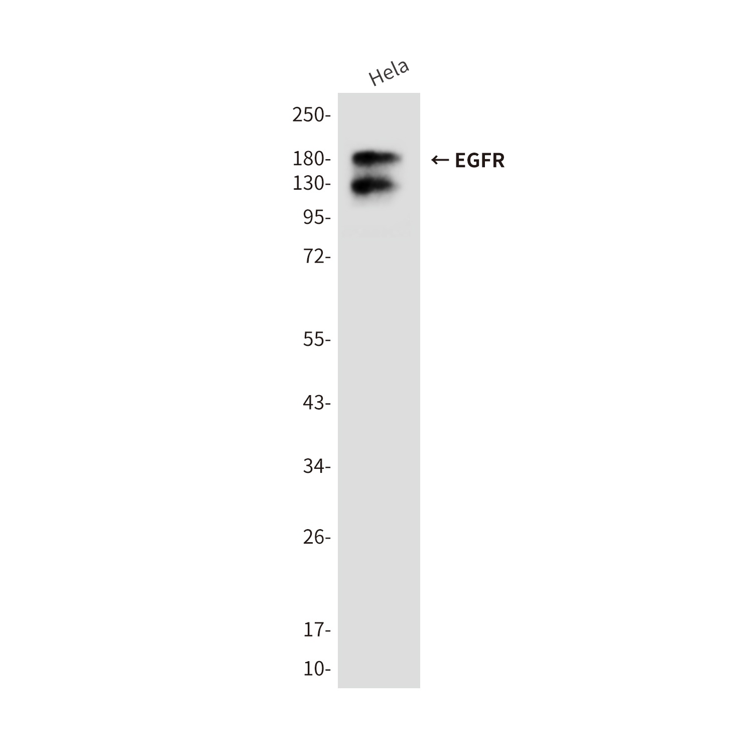EGFR (5E9) Mouse mAb