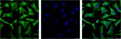 NF-KB p65 (3D2) Mouse mAb