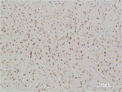 NF-KB p65 (3D2) Mouse mAb