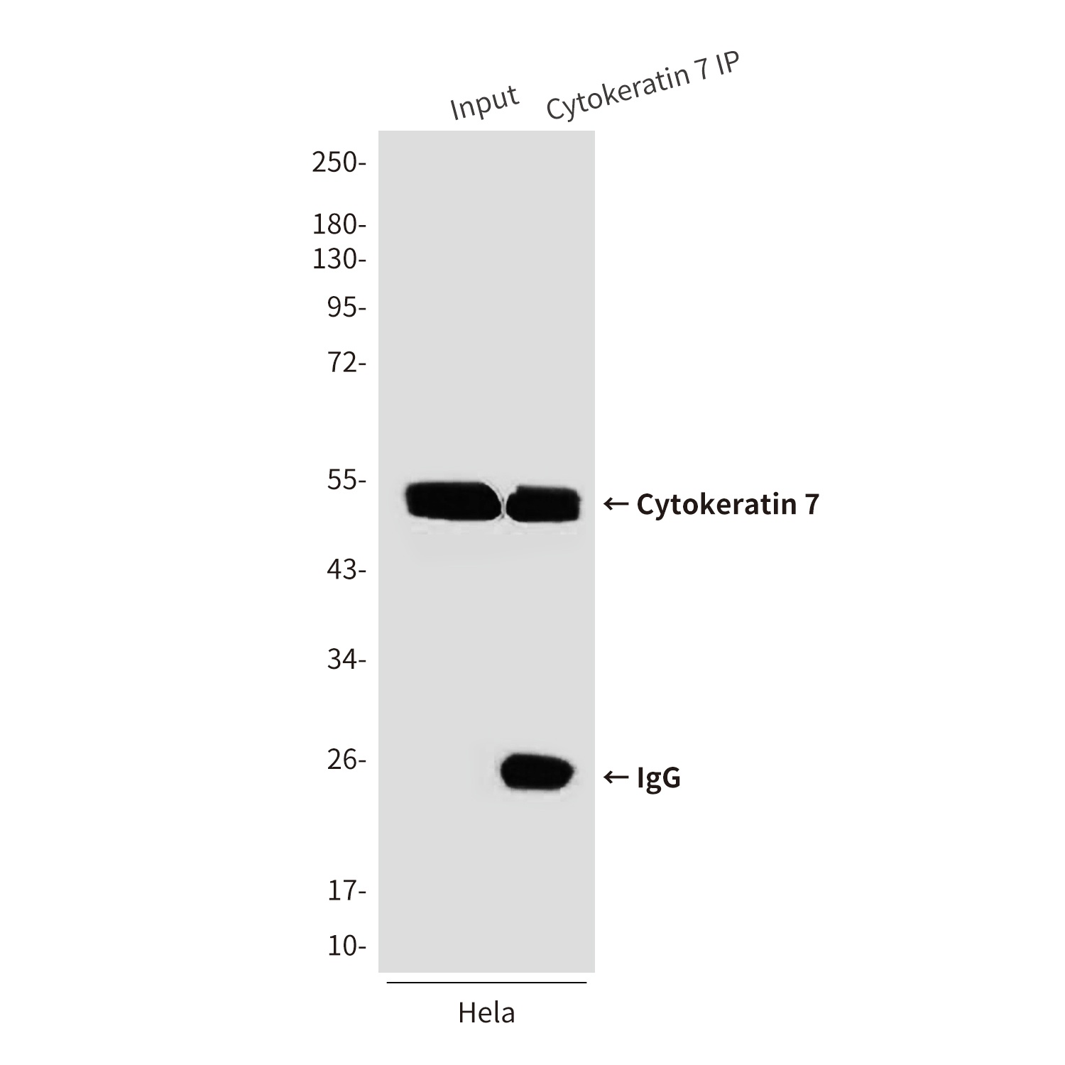 Cytokeratin 7 (9G9) Mouse mAb