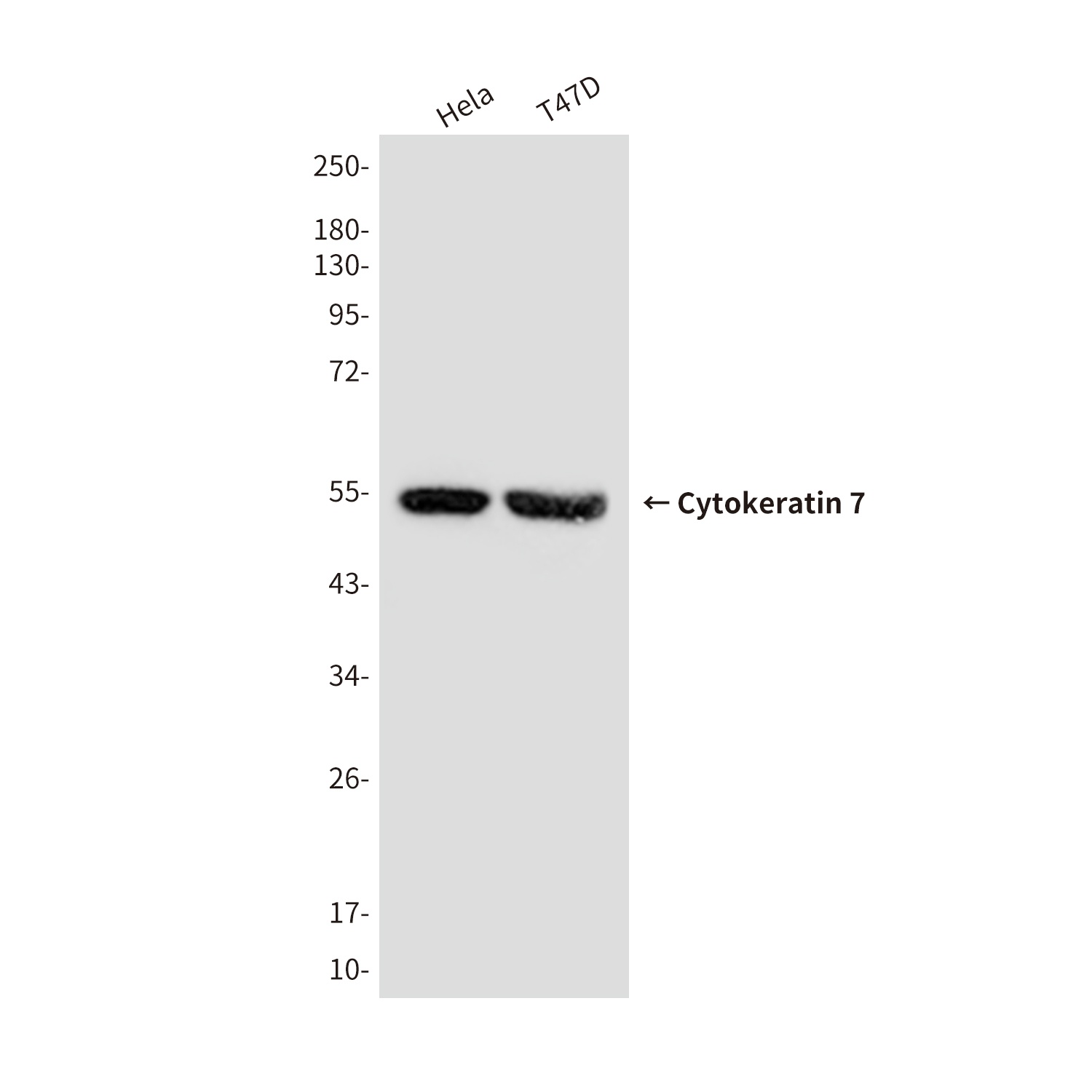 Cytokeratin 7 (9G9) Mouse mAb