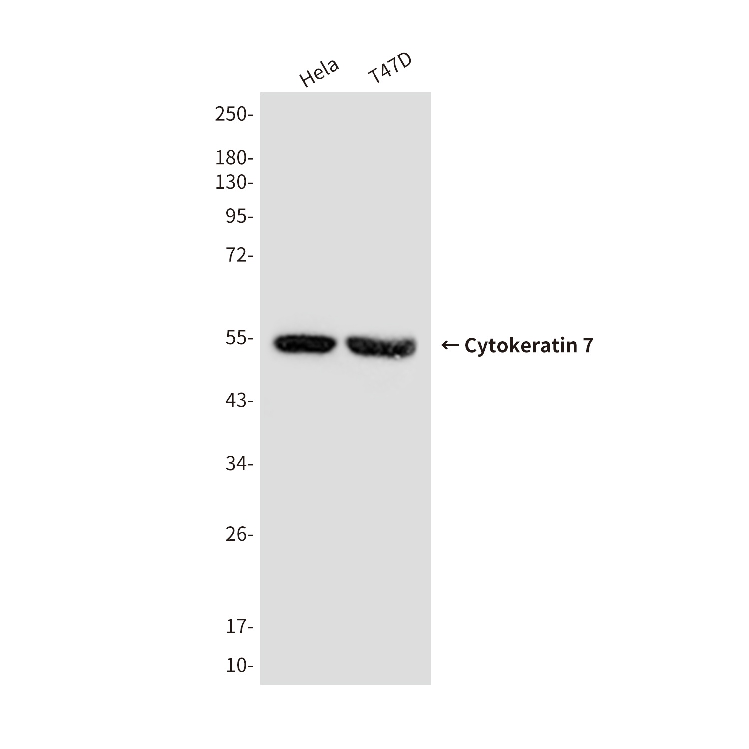 KRT7 Antibody