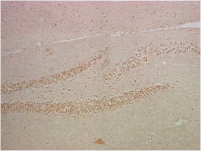 NF-KB p65 (5A10) Mouse mAb