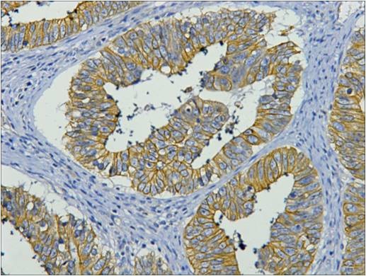 Cytokeratin 19 (10G10) Mouse mAb