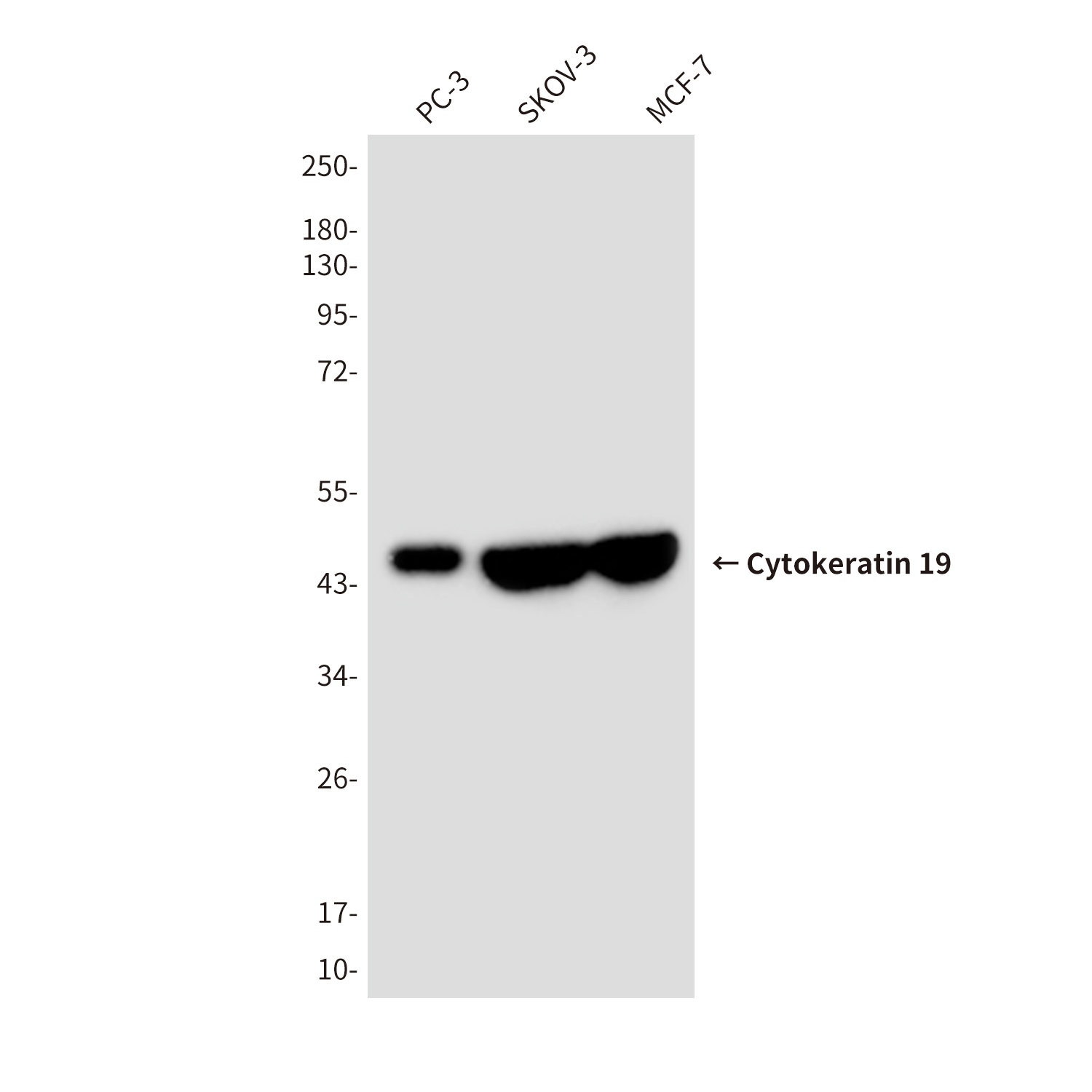 Cytokeratin 19 (10G10) Mouse mAb