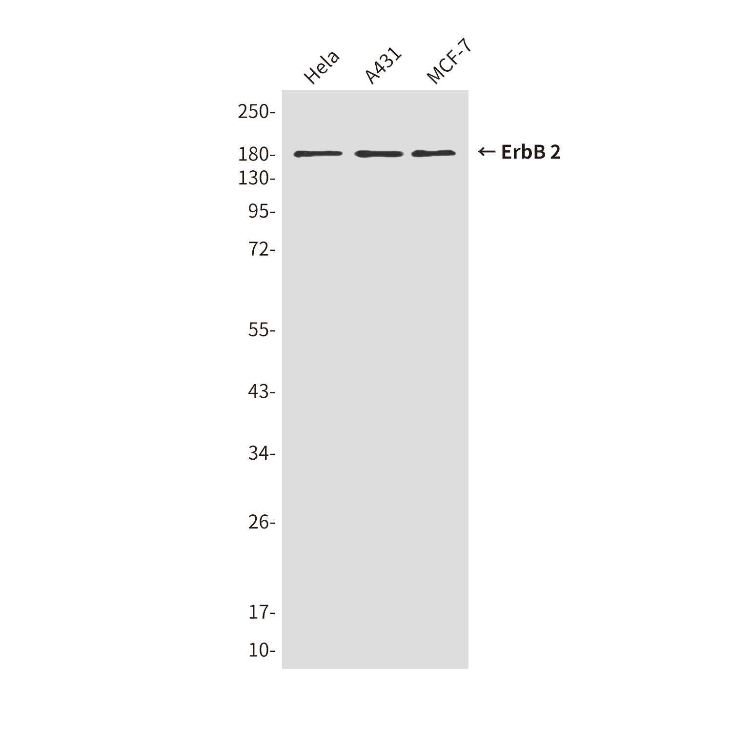 ErbB 2 (1C4) Mouse mAb