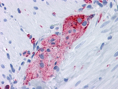 Synaptophysin (10C8) Mouse mAb
