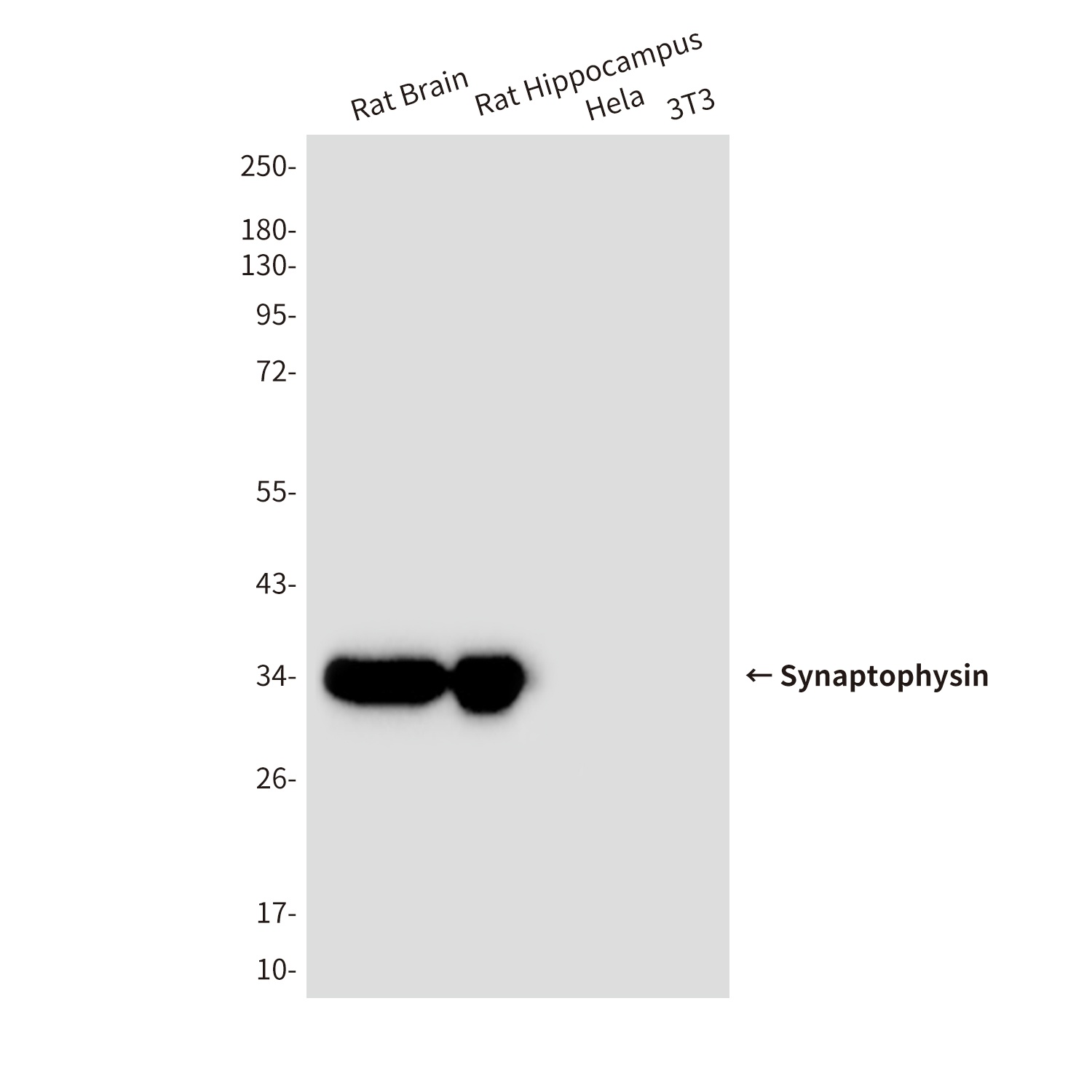 Synaptophysin (10C8) Mouse mAb