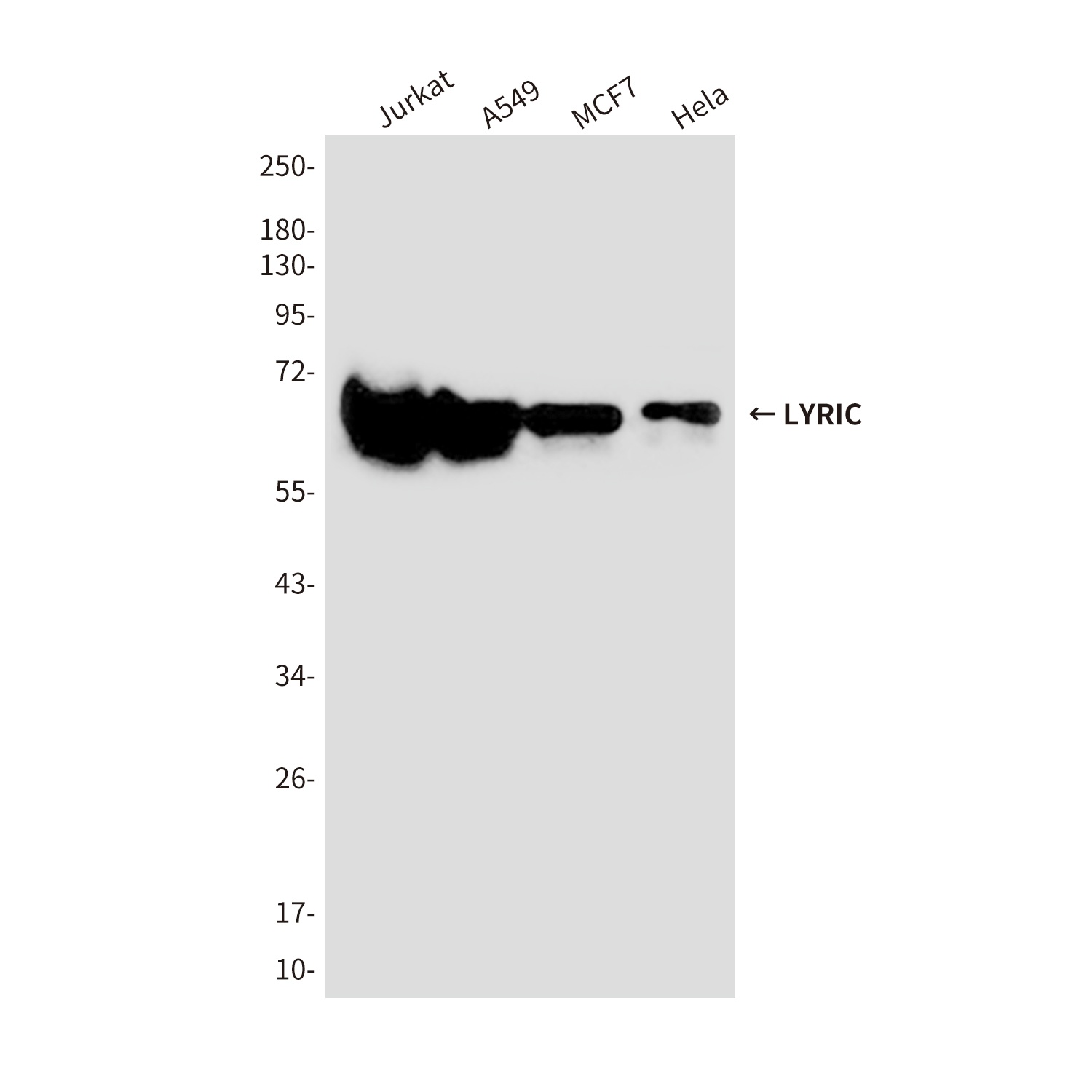 LYRIC/AEG1 Mouse Monoclonal Antibody