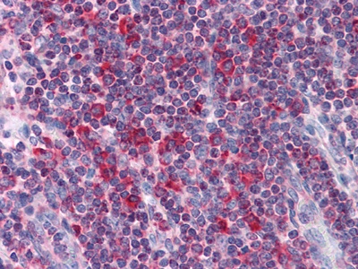 LYRIC/AEG1 Mouse Monoclonal Antibody