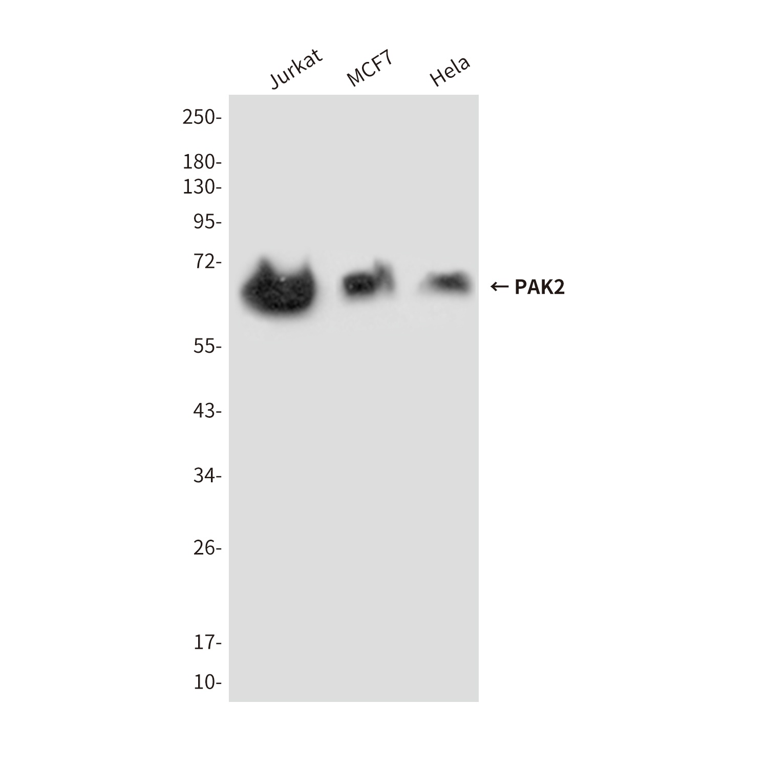 PAK2 (7H3) Mouse mAb