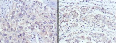 PAK2 (7H3) Mouse mAb