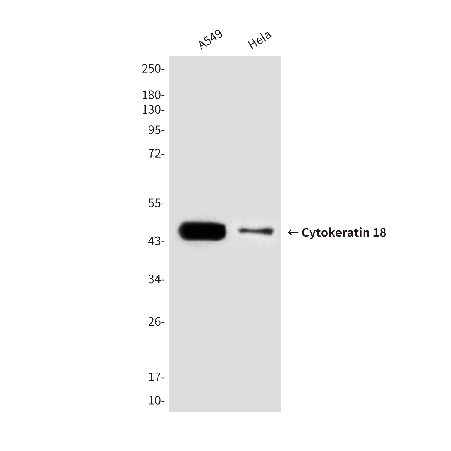 KRT18 Antibody