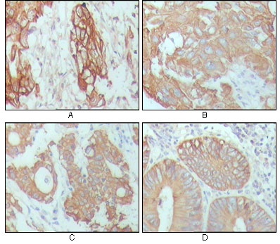 KRT18 Antibody