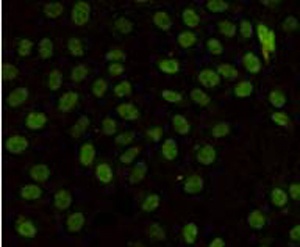 MLH1 Antibody