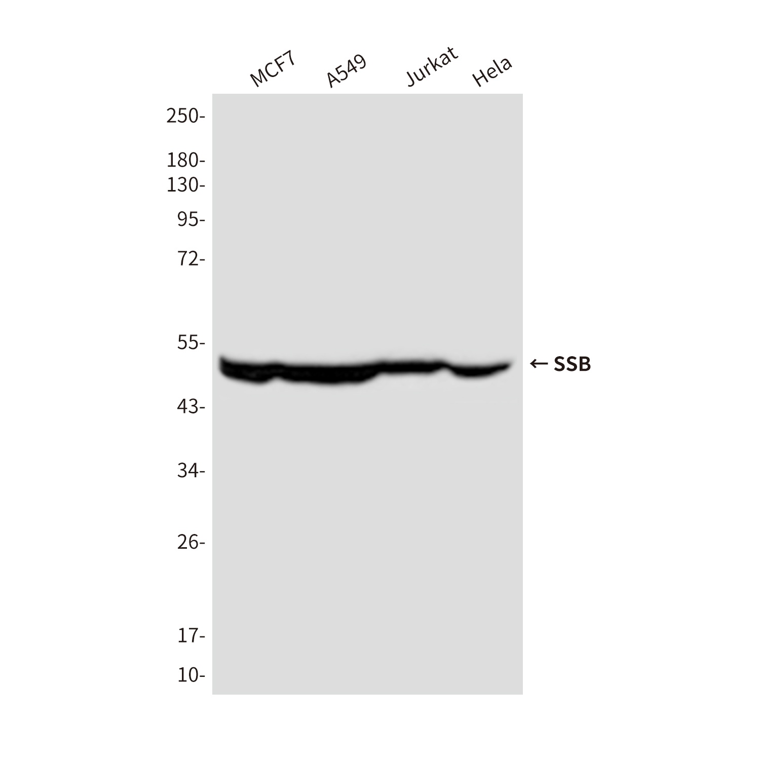 SSB Mouse Monoclonal Antibody