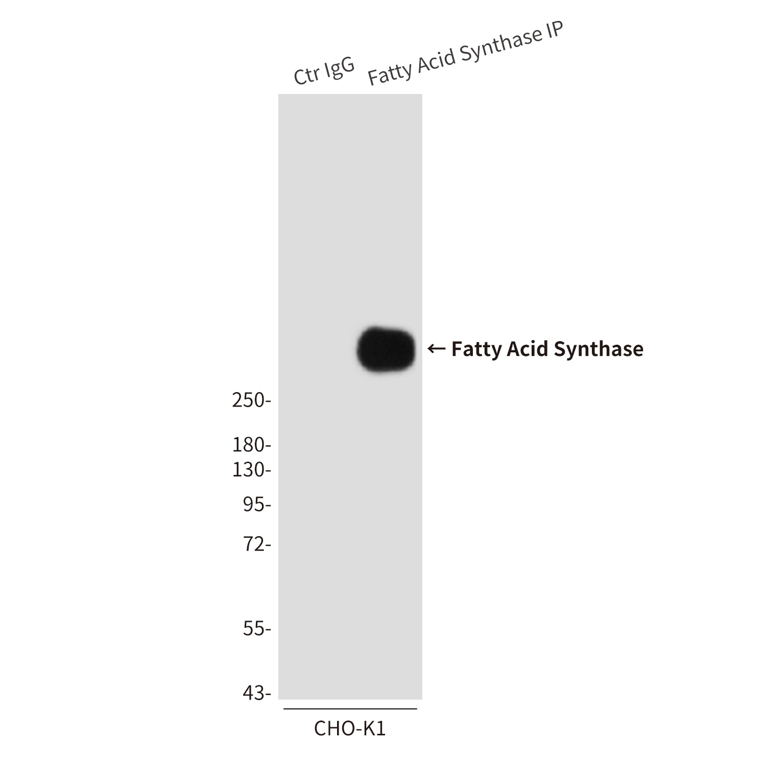 Fatty Acid Synthase (6B9) Mouse mAb
