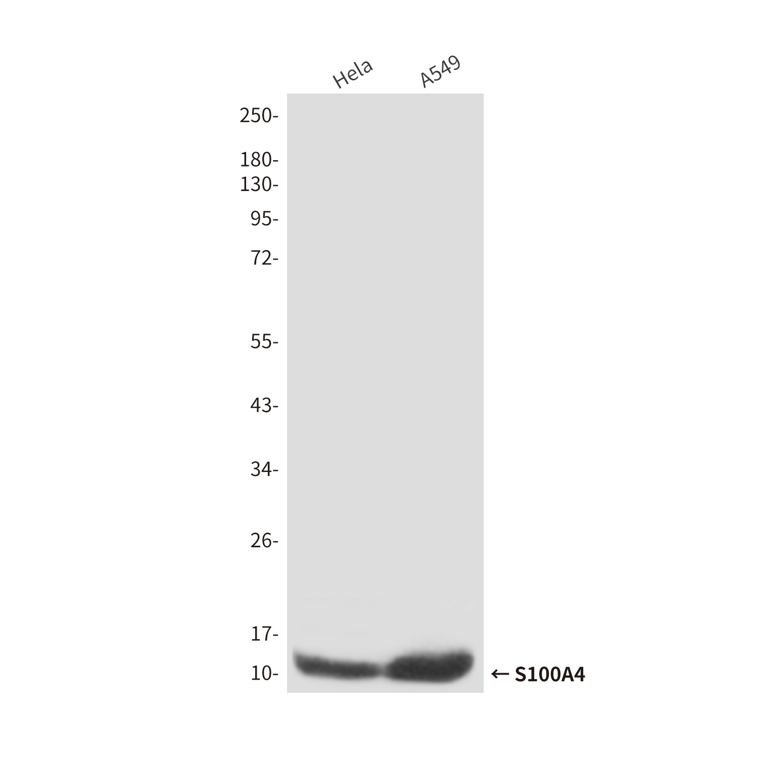 S100A4 Mouse Monoclonal Antibody