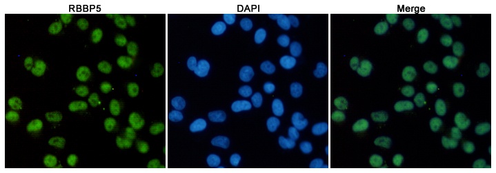 RBBP5 (1C9) Mouse mAb