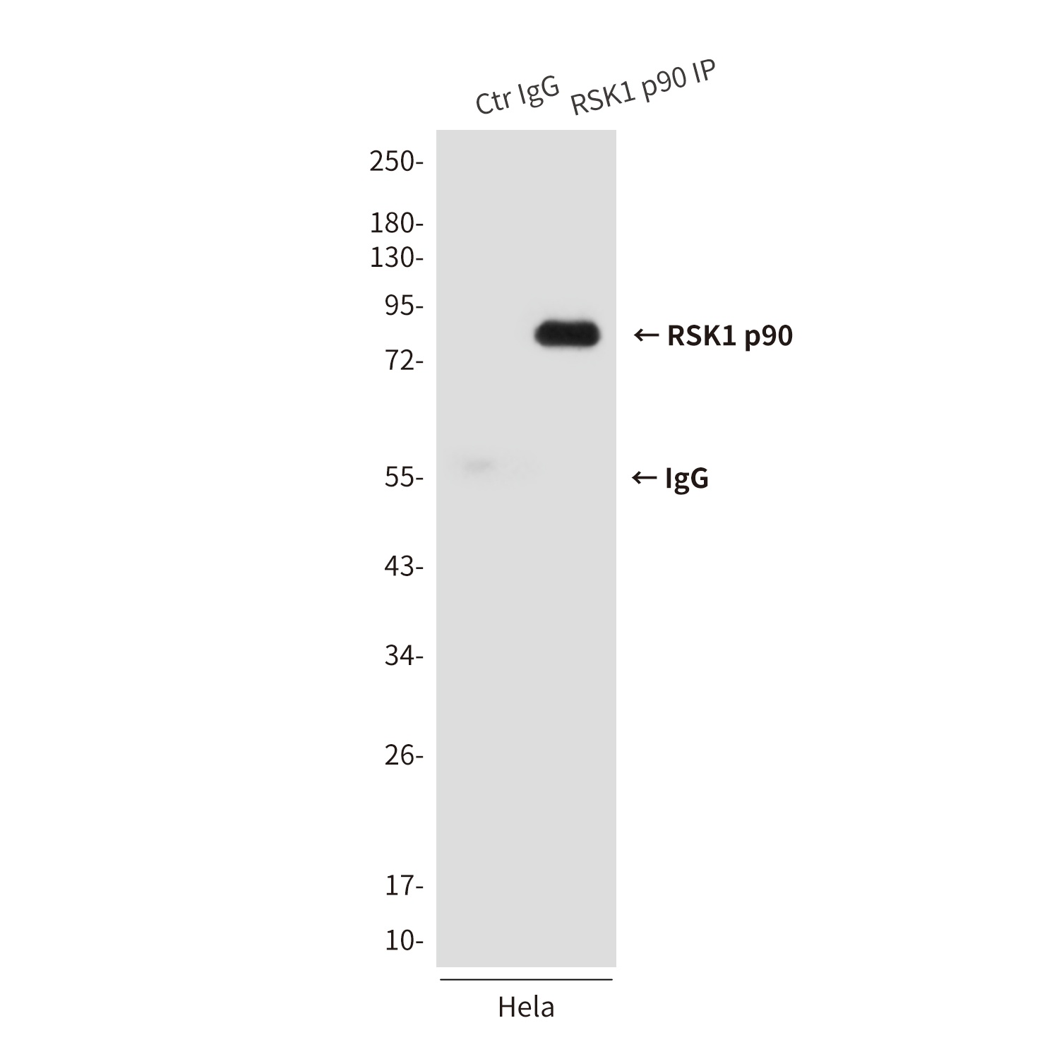 RPS6KA1 Antibody