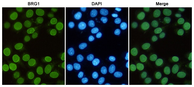 BRG1 (6D7) Mouse mAb