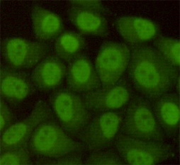 RAD23B Antibody